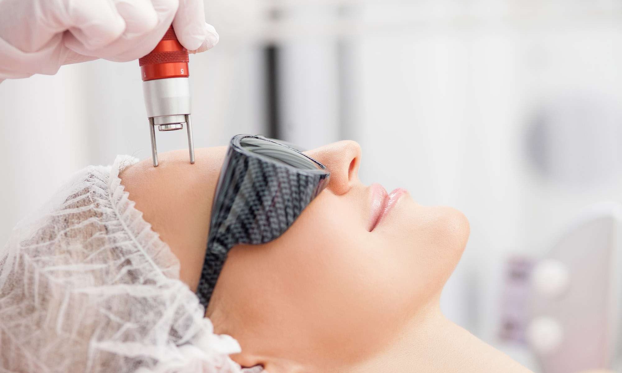 Laser Resurfacing Treatment in Lahore, Karachi, Islamabad, Pakistan